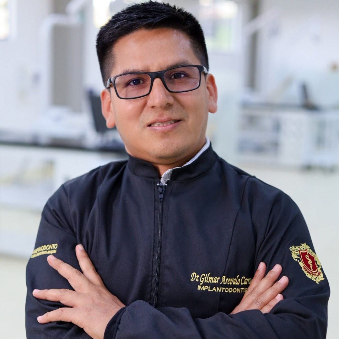 Gilmer Arevalo Carranza